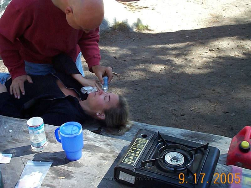 28. Ken puts drops in Miren's eye after all the dust the night before..jpg